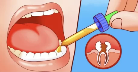 Gum Disease & Tooth Decay